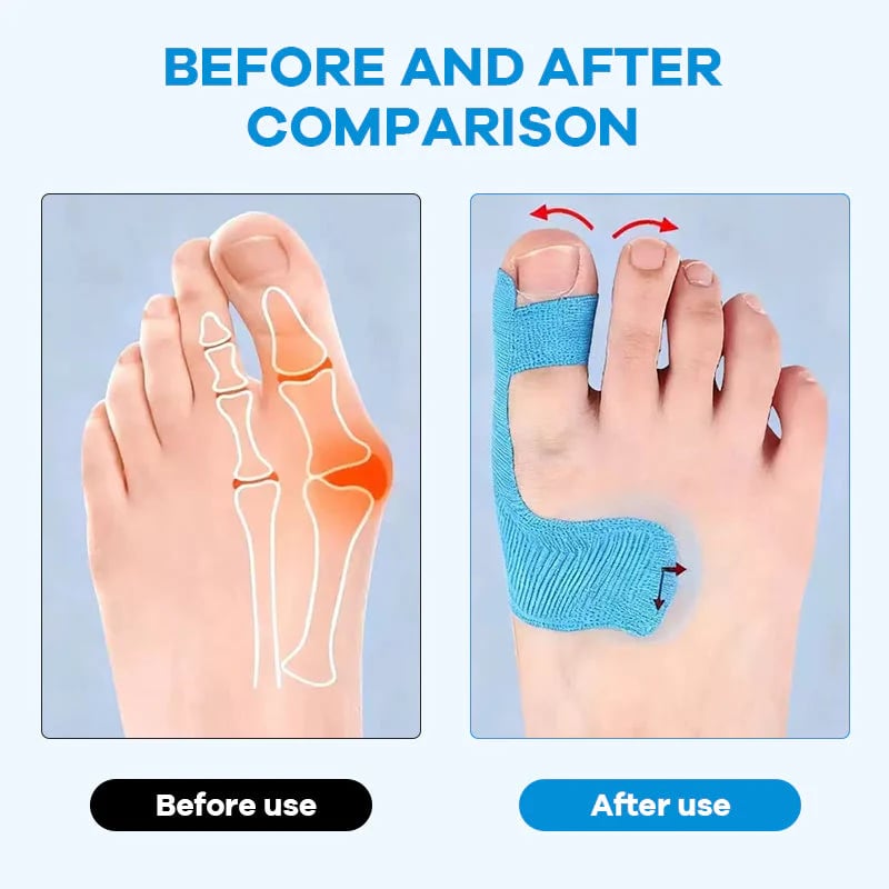 👣Pre-cut Bunion Corrector Kinesiology Tape