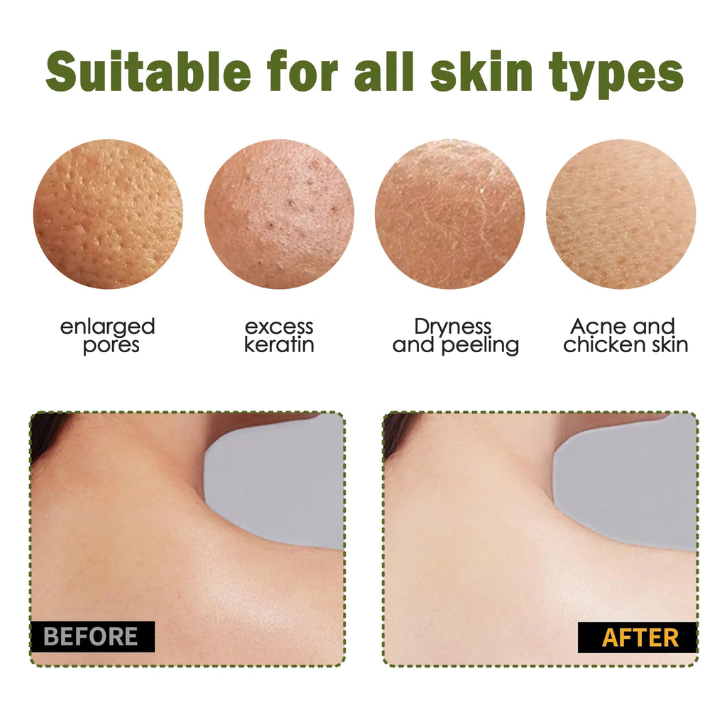 🧤 Exfoliating Gloves – Instantly Remove Dead Skin